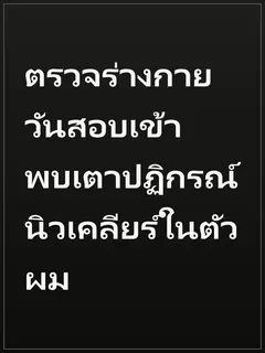 ตรวจร่างกายวันสอบเข้า พบเตาปฏิกรณ์นิวเคลียร์ในตัวผม